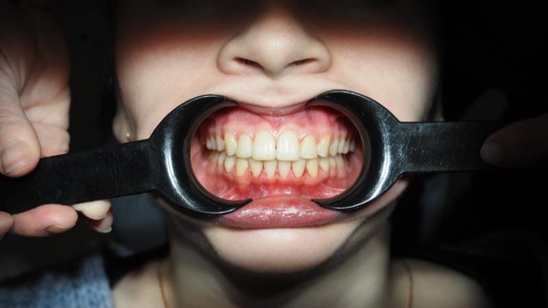 Patrycja po leczeniu