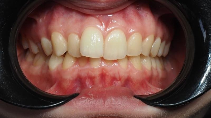 Patrycja przed leczeniem